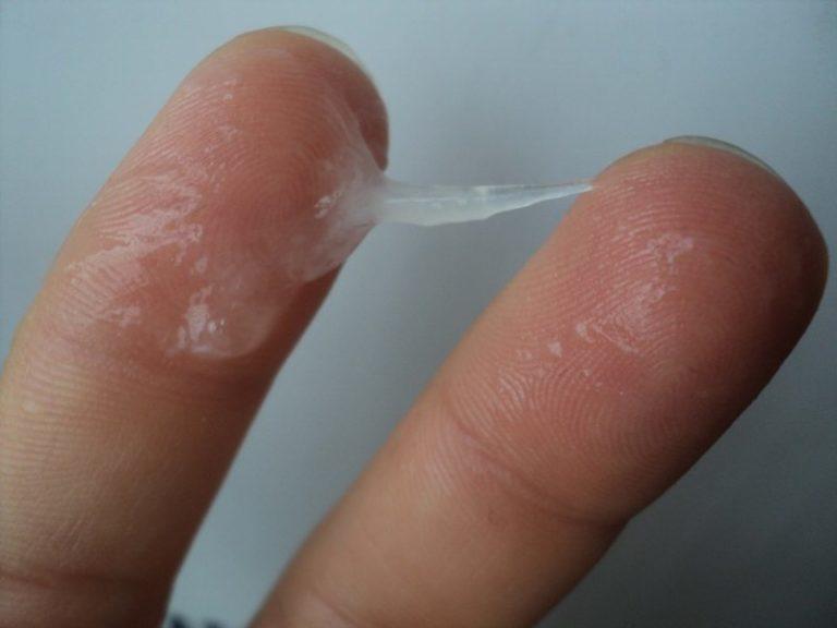 Выделения из влагалища: причины и лечение