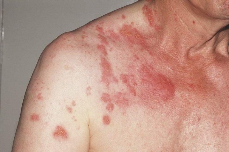 Боль в правом боку под ребрами причины и лечение