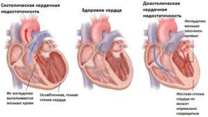 Где находится область солнечного сплетения у человека фото