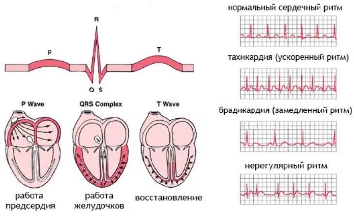 Что значит синусовый ритм в кардиограмме