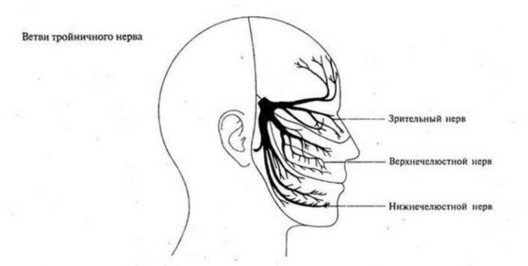 Воспаление тройничного нерва фото симптомы