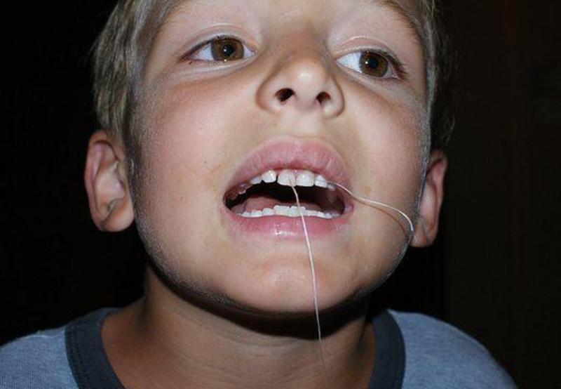 Вырывание молочного зуба ниткой