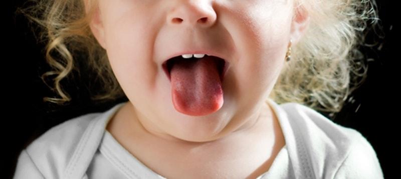 Высунутый язык у ребенка