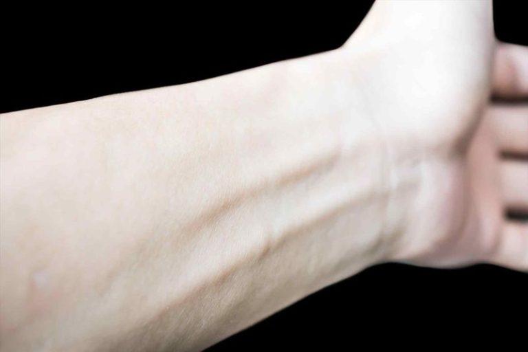 Анемия: лечение, симптомы, степени, причины и код МКБ 10