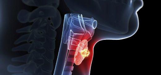Киста в щитовидной железе – чем опасна?