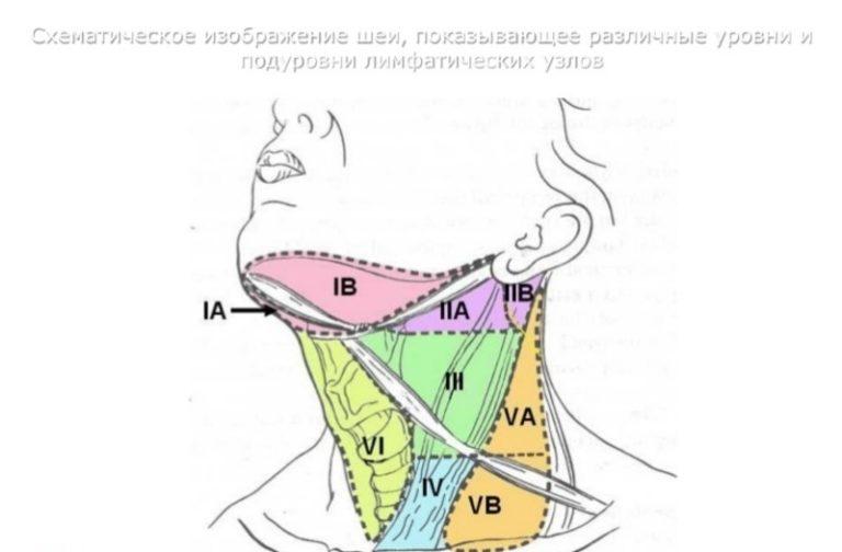 Где находятся лимфоузлы на шее фото у женщин