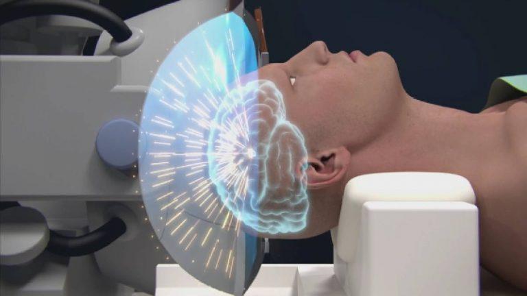 Тремор головы: 25 причин и лечение