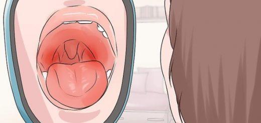 Опух язычок в горле – что делать?