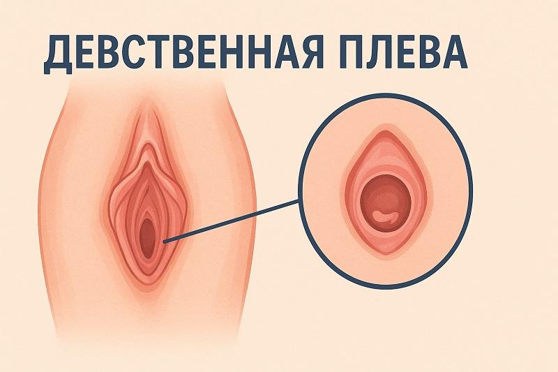 Девственная плева (гимен)