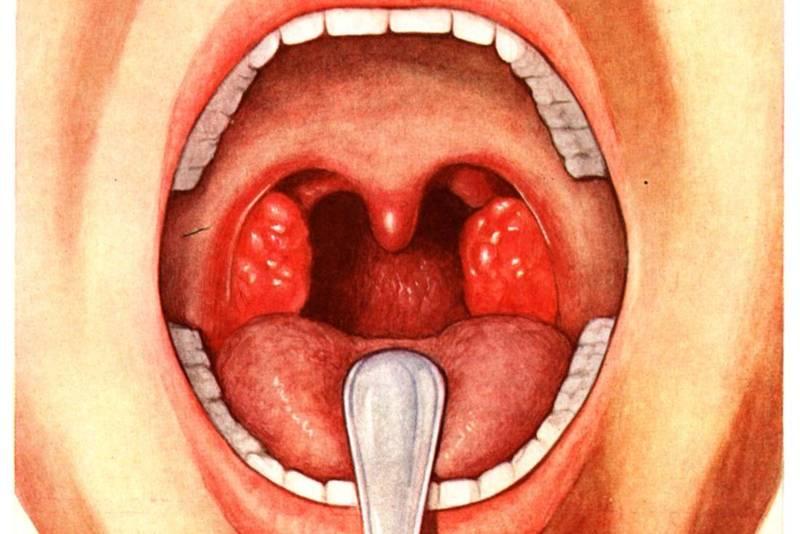 Стрептококк гемолитический в горле норма 31