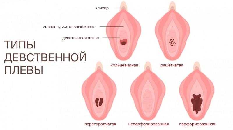 Виде девственной плевы