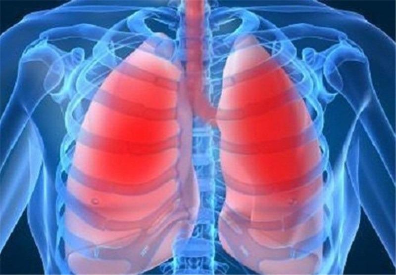 воспаление лёгких