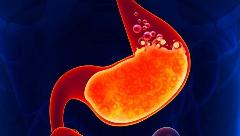 Желчь в желудке: лечение, 10 причин и симптомов